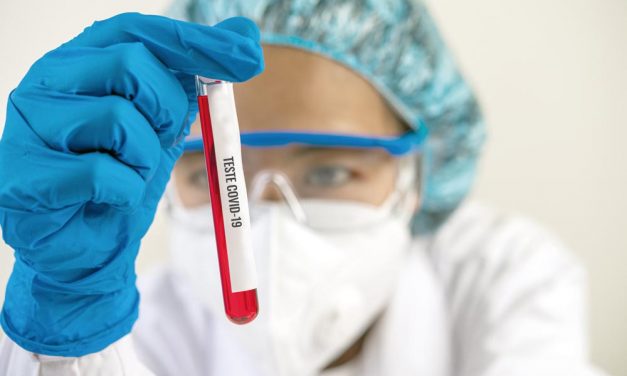 Testes Covid-19 exclusivos aos profissionais da saúde são feitos em apenas 24 horas por laboratório de Cascavel